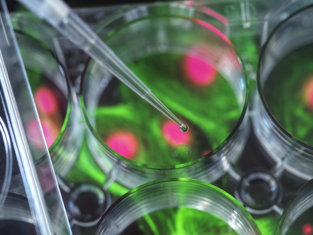 Fluorescent human chemokine (C-X-C motif) receptor 2 Internalization Assay Cell Line