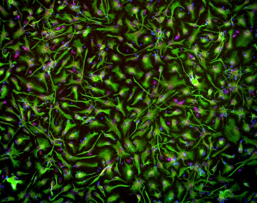 [25sk126] Cortical Astrocytes